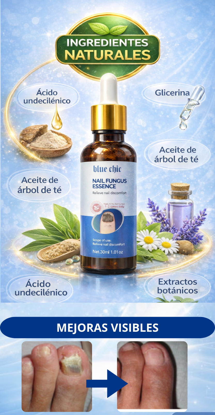 ANTIHONGOS BLUE CHIC