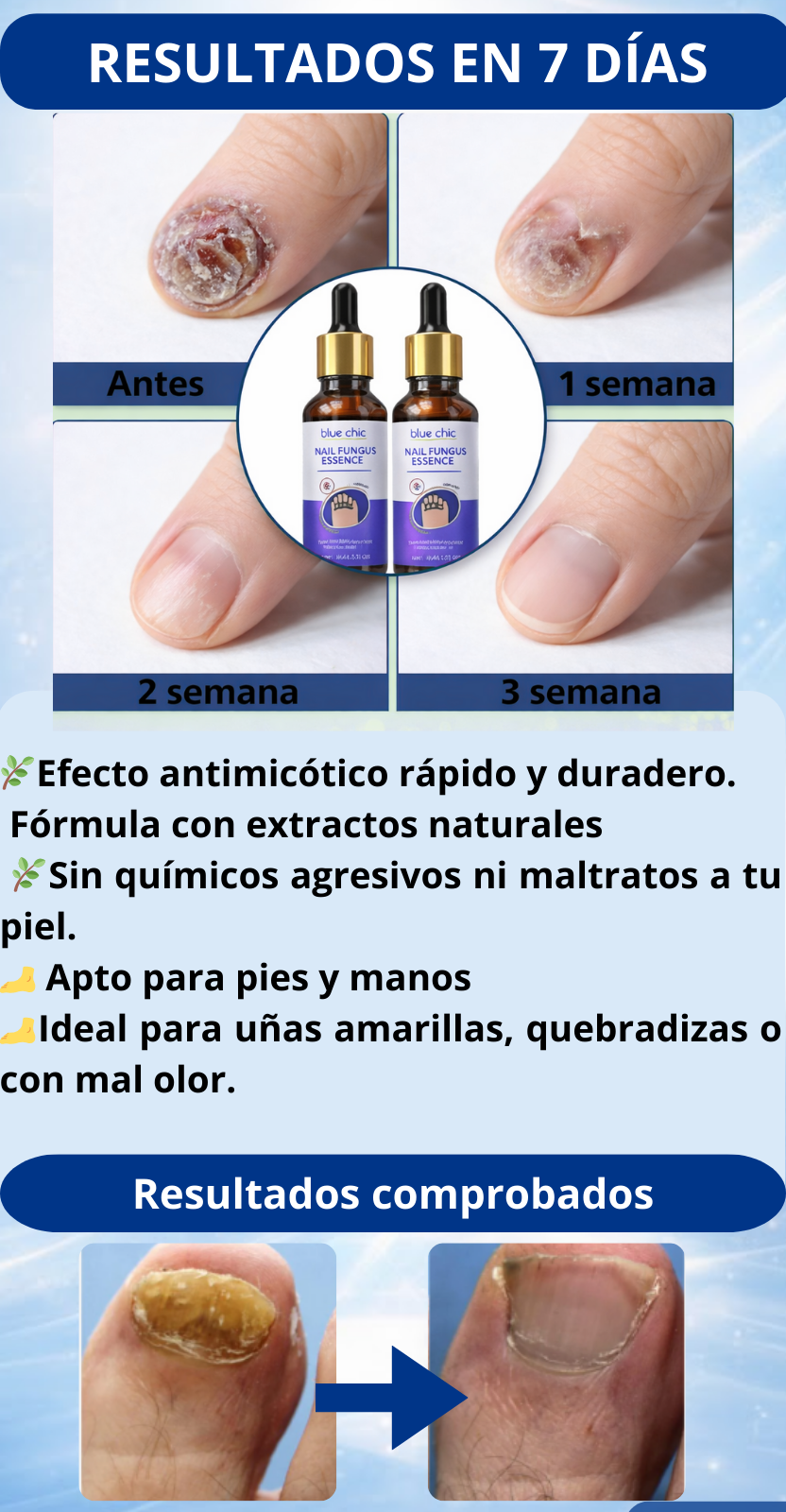 ANTIHONGOS BLUE CHIC