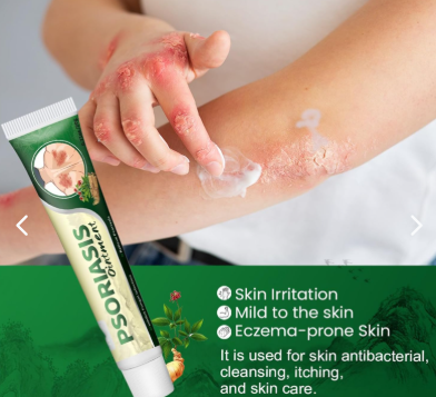 Ungento para piel irritada