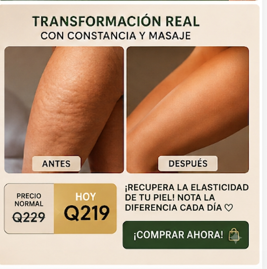 ✨ ACEITE ANTICELULITIS | Piel Más Firme y Suave 💚