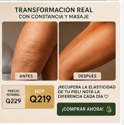 ✨ ACEITE ANTICELULITIS | Piel Más Firme y Suave 💚